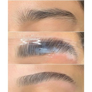 Lamination des sourcils (Browlift) 